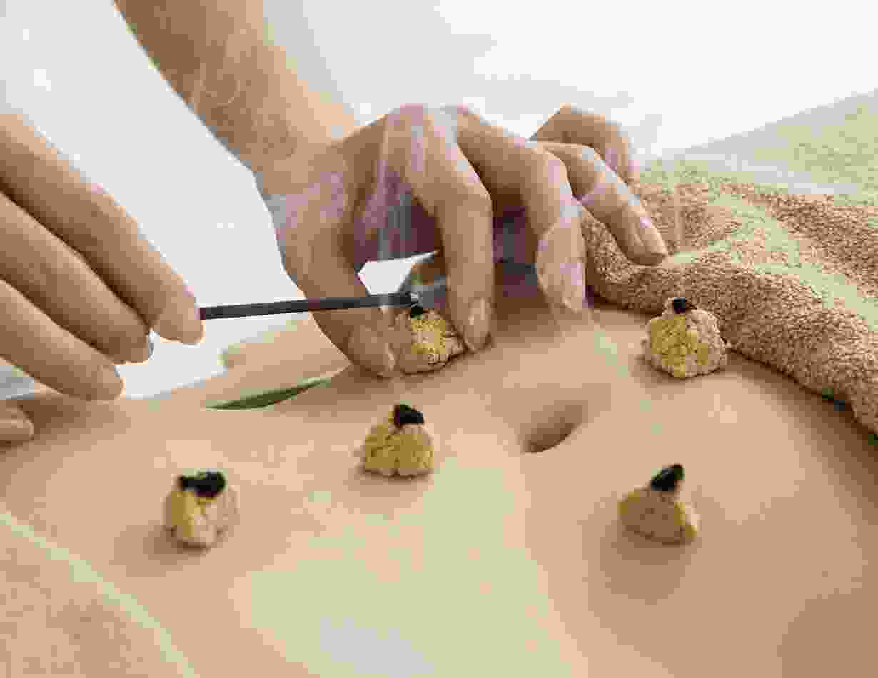 Moxibustion